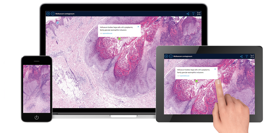 Application of PathoZoom on browser-based devices like smartphone, tablet and computer