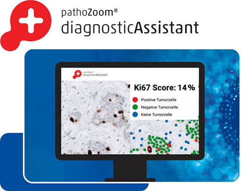 Product image diagnosis on the computer using the artificial intelligence of the PathoZoom Diagnostic Assistant