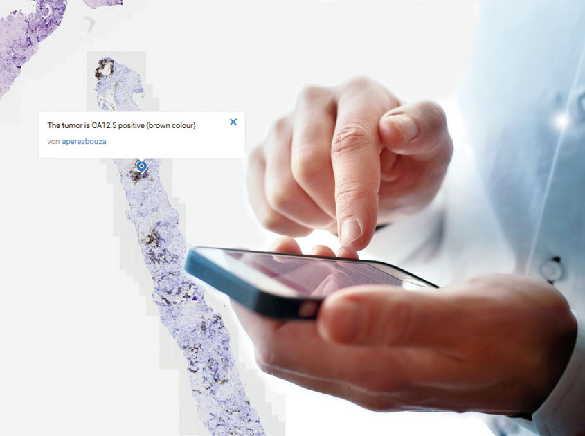 Demonstration of digital pathology using PathoZoom on the Smartphone
