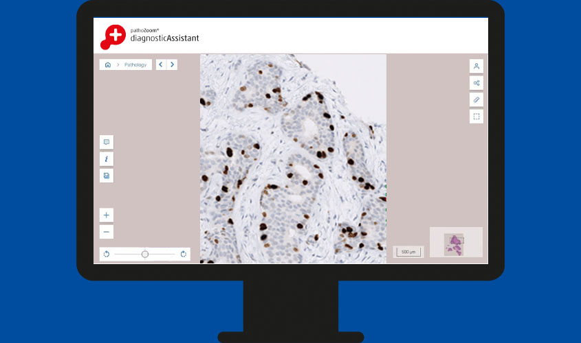 PathoZoom Diagnostic Assistant bei der Auswertung von Zellen