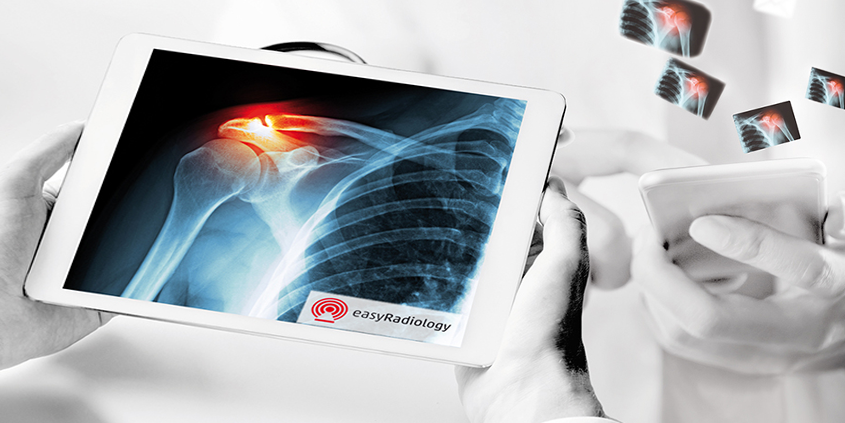 Radiologist uses the smart referral portal EasyRadiology per Tablet