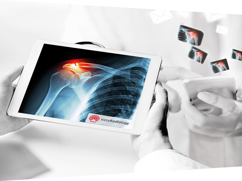 Radiologist uses the smart referral portal EasyRadiology per Tablet