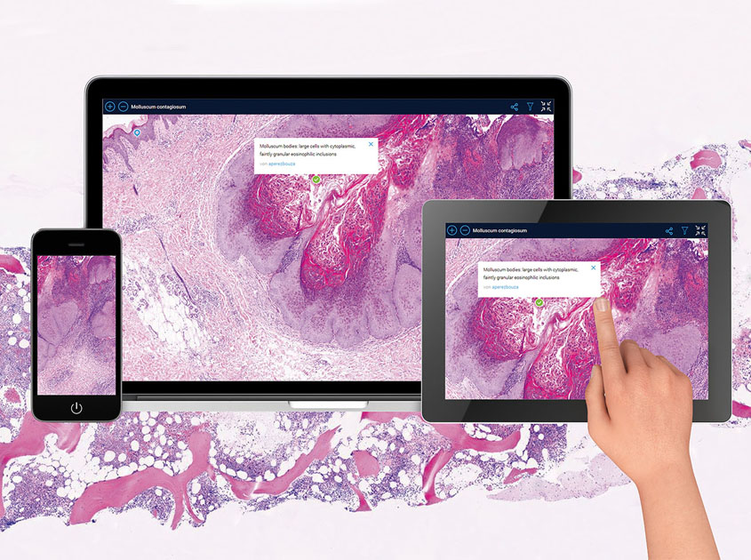 Histologisches Slides auf dem PC, Tablet und Smartphone