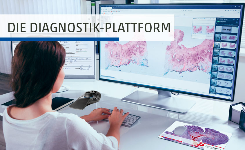 Diagnostozieren am Bildschirm in der Diagnostik-Plattform PathoZoom Digital Lab