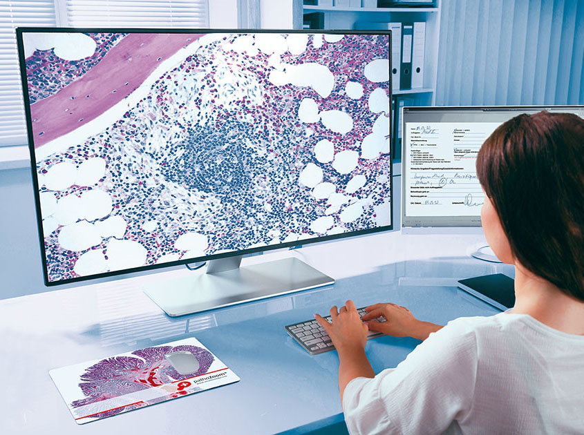 Pathologist diagnoses digitally at her desk