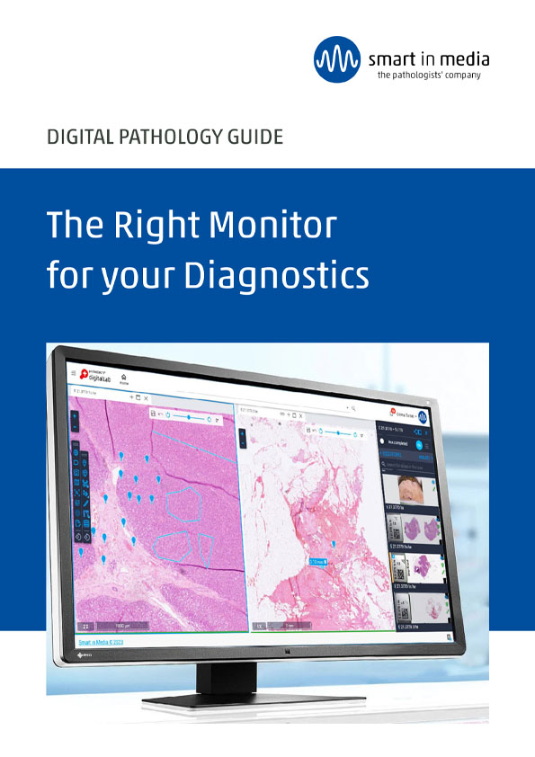 Should I buy a smart monitor? - PC Guide