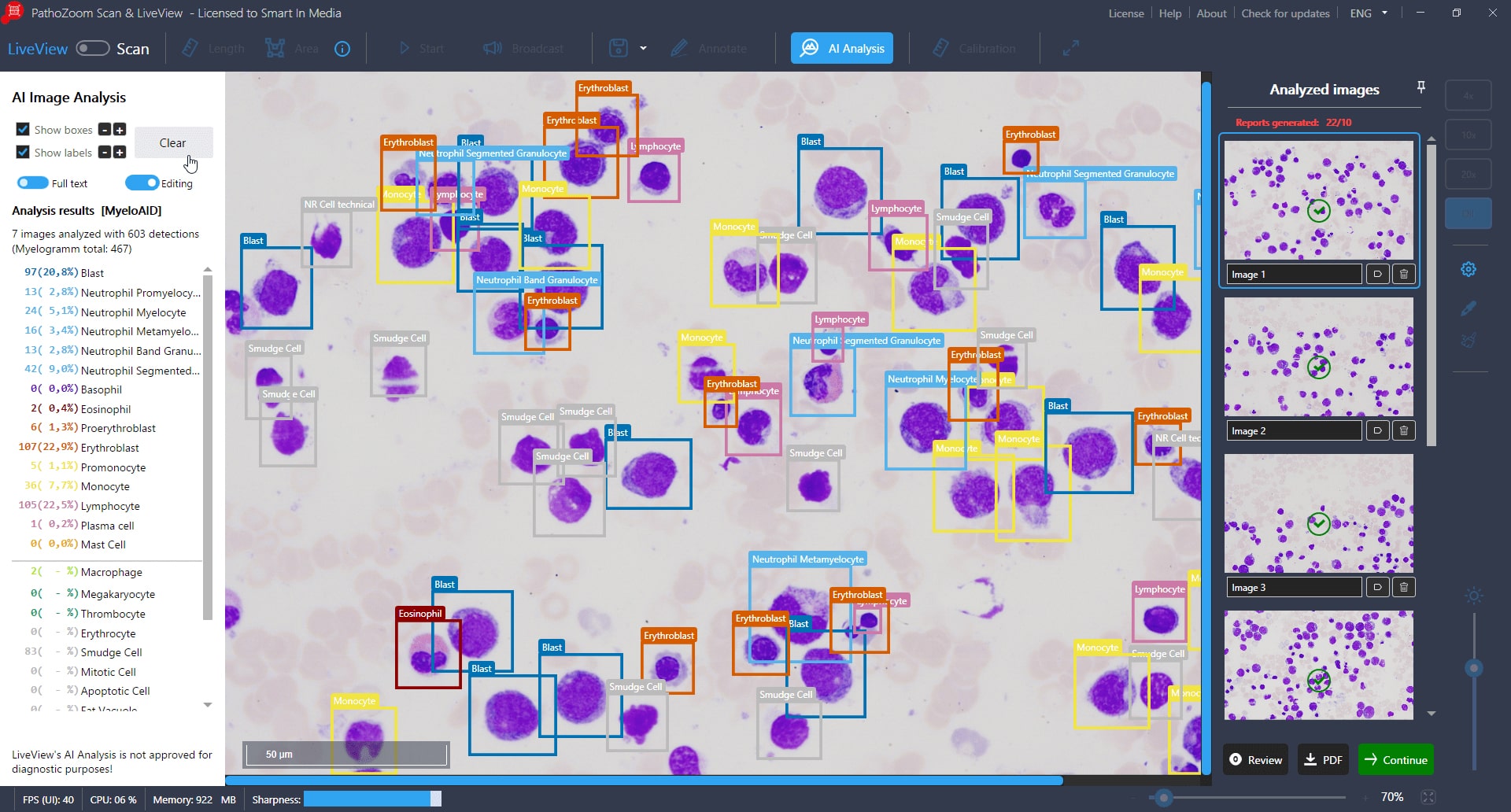 MyeloAID 02 Analysiert-min 2025-10-30
