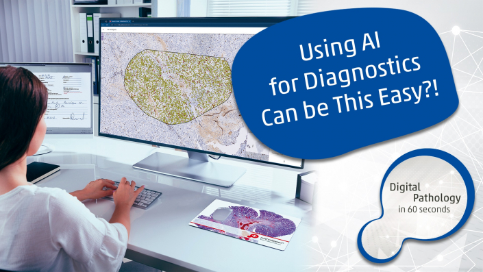 DP60S 01 KI Thumbnail